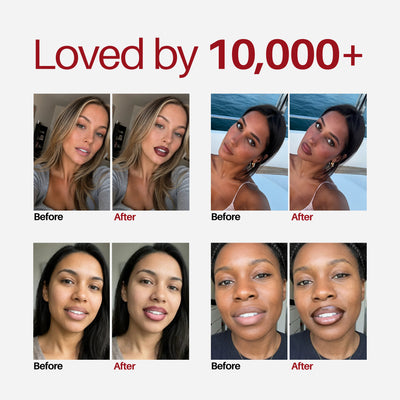 Bubble Lip Pen — loved by 10,000+ customers, before and after