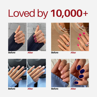 Ruby Nail Pen — loved by 10,000+ customers, before and after results